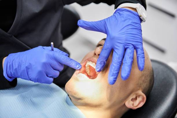 Best Emergency Tooth Extraction in Grantsville, UT