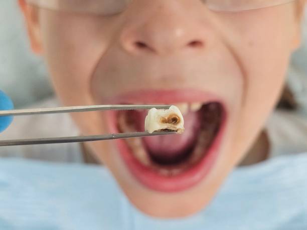 Best Emergency Treatment for Toothache in Grantsville, UT